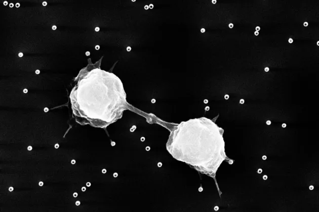 Photo of two cells hanging on to each other.